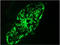 Keratin 8 antibody, AM10103PU-N, Origene, Immunofluorescence image 