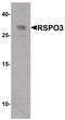 R-Spondin 3 antibody, PA5-38052, Invitrogen Antibodies, Western Blot image 