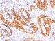 Mucin 1, Cell Surface Associated antibody, V3138IHC-7ML, NSJ Bioreagents, Immunohistochemistry frozen image 
