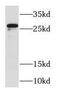 RAB23, Member RAS Oncogene Family antibody, FNab07006, FineTest, Western Blot image 