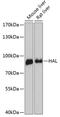 HAL antibody, A02612, Boster Biological Technology, Western Blot image 