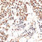 Minichromosome Maintenance Complex Component 5 antibody, LS-C748562, Lifespan Biosciences, Immunohistochemistry paraffin image 