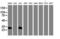 Nicotinamide N-Methyltransferase antibody, M02676, Boster Biological Technology, Western Blot image 