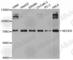 Neural Precursor Cell Expressed, Developmentally Down-Regulated 9 antibody, A2521, ABclonal Technology, Western Blot image 
