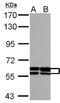 Growth Differentiation Factor 5 antibody, NBP2-16632, Novus Biologicals, Western Blot image 