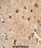 Carboxylesterase 5A antibody, abx034251, Abbexa, Immunohistochemistry paraffin image 