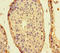 Centrosomal Protein 104 antibody, LS-C679561, Lifespan Biosciences, Immunohistochemistry paraffin image 