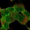 Musashi RNA Binding Protein 1 antibody, HPA064401, Atlas Antibodies, Immunocytochemistry image 