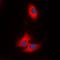 5-Azacytidine Induced 2 antibody, orb215262, Biorbyt, Immunofluorescence image 