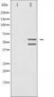 Mitogen-Activated Protein Kinase 8 antibody, TA325663, Origene, Western Blot image 