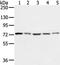 Protein-glutamine gamma-glutamyltransferase 4 antibody, TA350532, Origene, Western Blot image 