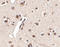 Mex-3 RNA Binding Family Member A antibody, A15239, Boster Biological Technology, Immunohistochemistry paraffin image 