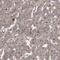 Protein Kinase D1 antibody, HPA029834, Atlas Antibodies, Immunohistochemistry frozen image 