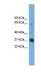 Coiled-Coil Domain Containing 127 antibody, NBP1-57061, Novus Biologicals, Western Blot image 