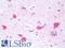 G3BP Stress Granule Assembly Factor 2 antibody, LS-B9861, Lifespan Biosciences, Immunohistochemistry paraffin image 