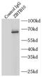 Zinc Finger And BTB Domain Containing 10 antibody, FNab09587, FineTest, Immunoprecipitation image 
