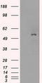 Solute Carrier Family 2 Member 5 antibody, LS-C797094, Lifespan Biosciences, Western Blot image 