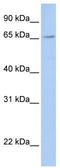 Fragile X mental retardation syndrome-related protein 2 antibody, TA345900, Origene, Western Blot image 