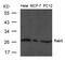 RAB5A, Member RAS Oncogene Family antibody, TA347833, Origene, Western Blot image 