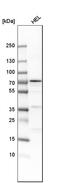 Arachidonate 12-lipoxygenase, 12S-type antibody, HPA010691, Atlas Antibodies, Western Blot image 