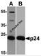 HIV-1 Gag polyprotein antibody, PM-6335, ProSci, Western Blot image 