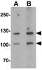 Crumbs homolog 2 antibody, GTX32104, GeneTex, Western Blot image 