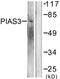Protein Inhibitor Of Activated STAT 3 antibody, TA326269, Origene, Western Blot image 