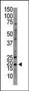 NME/NM23 Nucleoside Diphosphate Kinase 6 antibody, AP15031PU-N, Origene, Western Blot image 