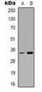 F11 Receptor antibody, orb319077, Biorbyt, Western Blot image 