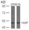 Vasodilator Stimulated Phosphoprotein antibody, 79-567, ProSci, Western Blot image 