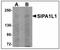 Signal Induced Proliferation Associated 1 Like 1 antibody, AP23918PU-N, Origene, Western Blot image 