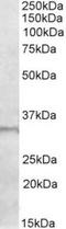 E2F Transcription Factor 6 antibody, TA311614, Origene, Western Blot image 
