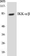 Component Of Inhibitor Of Nuclear Factor Kappa B Kinase Complex antibody, EKC1293, Boster Biological Technology, Western Blot image 
