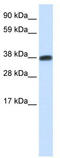 Doublesex- and mab-3-related transcription factor C2 antibody, TA329946, Origene, Western Blot image 