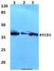 RNA 3'-Terminal Phosphate Cyclase antibody, A07570, Boster Biological Technology, Western Blot image 