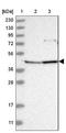 Ankyrin Repeat Domain 34A antibody, NBP1-90855, Novus Biologicals, Western Blot image 