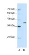 Exoribonuclease 1 antibody, orb324942, Biorbyt, Western Blot image 