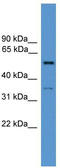 COCH antibody, TA342662, Origene, Western Blot image 