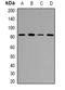 Zona pellucida sperm-binding protein 2 antibody, orb382496, Biorbyt, Western Blot image 