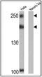 Nuclear Receptor Corepressor 2 antibody, MA1-843, Invitrogen Antibodies, Western Blot image 