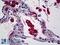 Mannose Receptor antibody, LS-B5474, Lifespan Biosciences, Immunohistochemistry paraffin image 