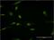 Solute Carrier Family 11 Member 2 antibody, H00004891-M03, Novus Biologicals, Immunofluorescence image 
