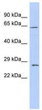 Claudin 18 antibody, TA333778, Origene, Western Blot image 