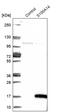 S100 Calcium Binding Protein A14 antibody, PA5-55666, Invitrogen Antibodies, Western Blot image 