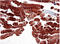 Actin Alpha 1, Skeletal Muscle antibody, AM33000PU-N, Origene, Immunohistochemistry paraffin image 
