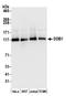 Damage Specific DNA Binding Protein 1 antibody, A300-462A, Bethyl Labs, Western Blot image 