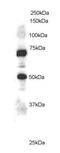 Engulfment And Cell Motility 1 antibody, ab2239, Abcam, Western Blot image 