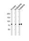 Integrin Subunit Beta 8 antibody, PA5-49404, Invitrogen Antibodies, Western Blot image 