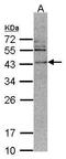 Calcium/Calmodulin Dependent Protein Kinase ID antibody, PA5-21643, Invitrogen Antibodies, Western Blot image 