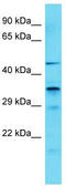 IST1 homolog antibody, TA331970, Origene, Western Blot image 